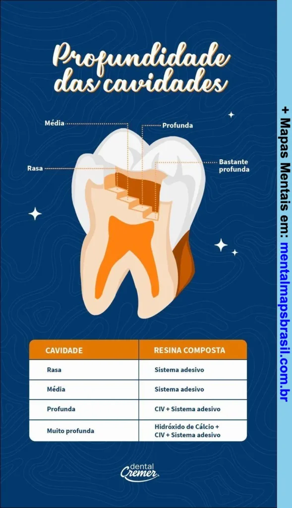 Mapa mental sobre profundidade das cavidades dentárias com tabela relacionando tipos de cavidades e sistemas de resina composta indicados.